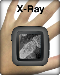 X-Ray